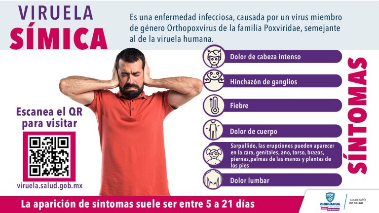 Informa Secretaría de Salud sobre los casos de viruela símica en Chihuahua