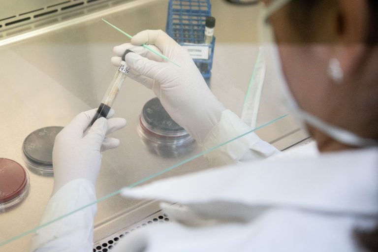 Descartan caso sospechoso de Viruela del Mono