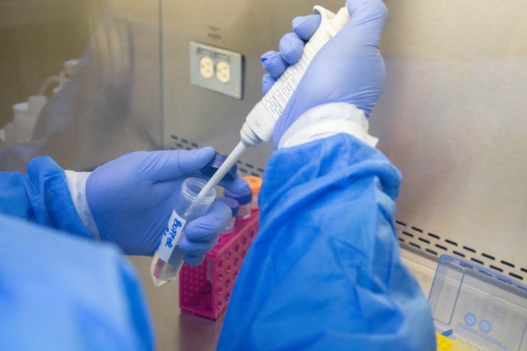 Descartan segundo caso sospechoso de viruela símica en Ciudad Juárez