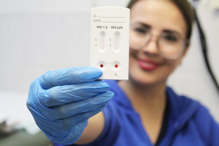 Invita Pensiones Civiles del Estado a realizarse prueba del VIH