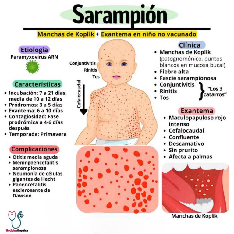 Muere niño rarámuri por sarampión