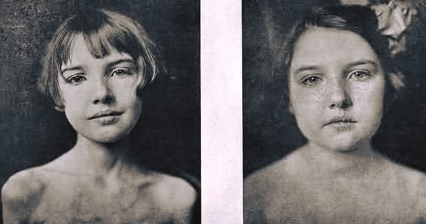 El milagro de la insulina