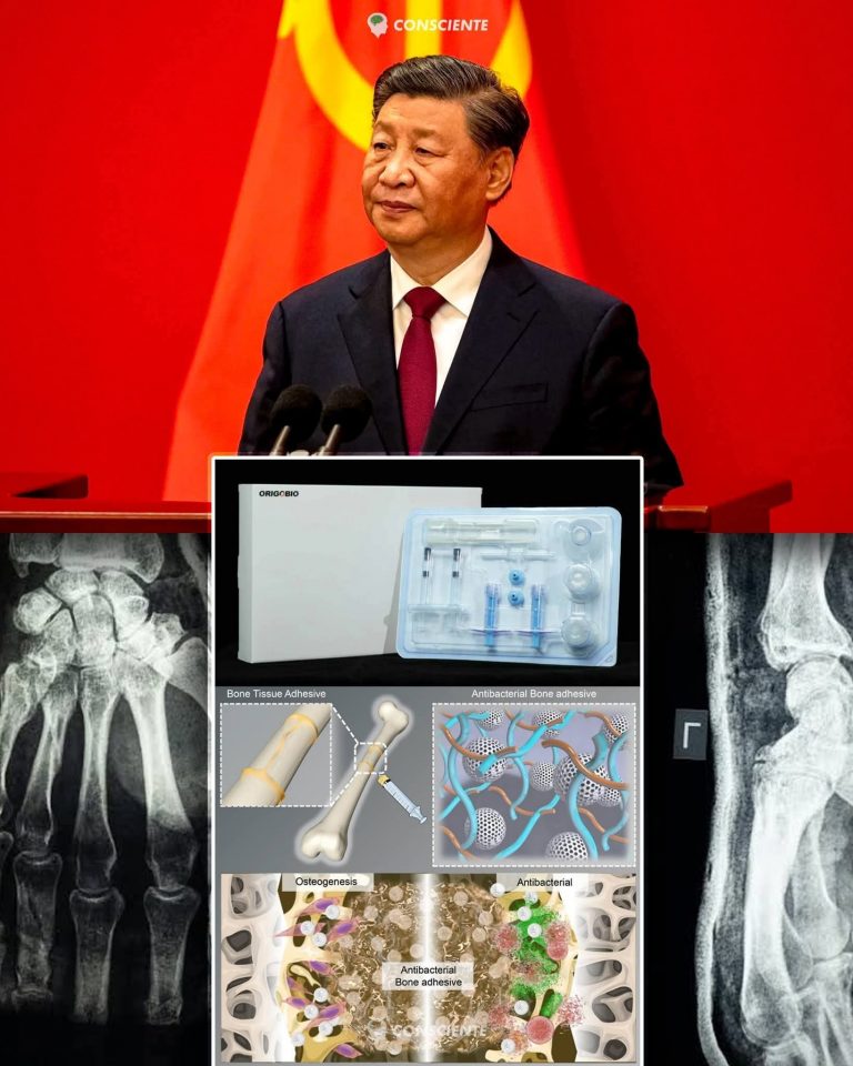 Científicos chinos desarrollan «pegamento óseo» que repara fracturas en 3 minutos
